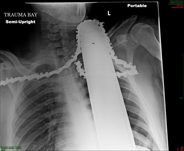 Chainsaw Necklace Nightmare